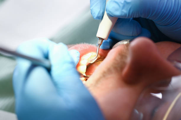 Best Same-Day Emergency Dentist in Crossville, TN