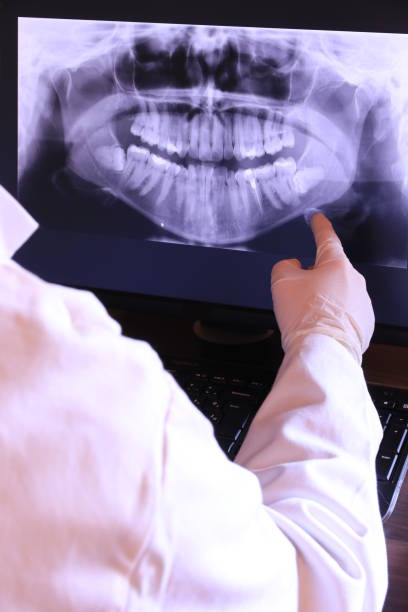 Best Emergency Root Canal Treatment in Crossville, TN